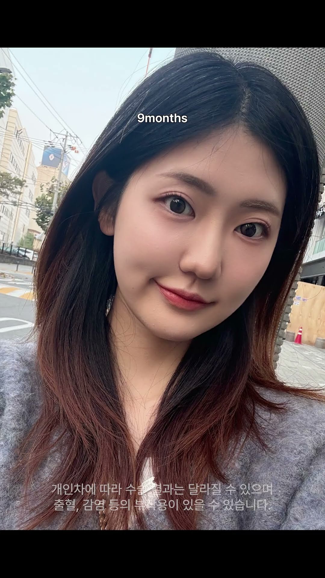 등록한썸네일