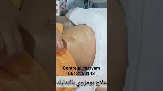 علاج بومزويحجامة مكناس مركز ال مريم 0613150143 علاج بومزوي بالتدليك والحجامة