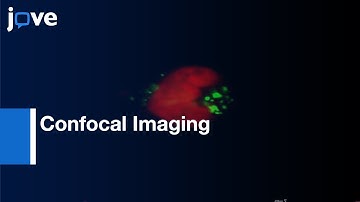 Confocal Imaging: Abnormal mitosis in cancer cells | Protocol Preview