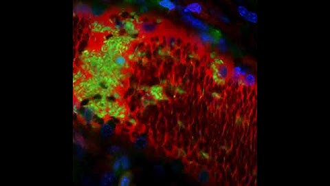 Two photon visualization of living mice: stochastic and dynamic cell behavior