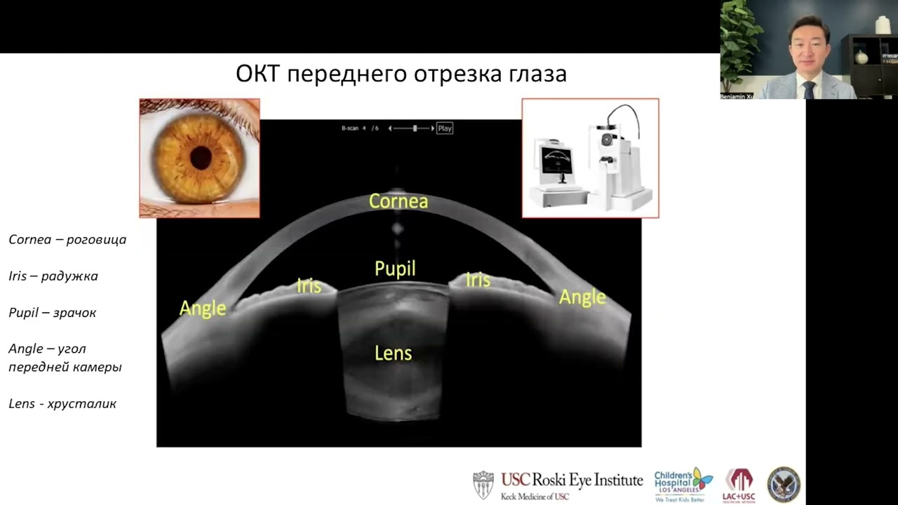 Using AI in Glaucoma Imaging