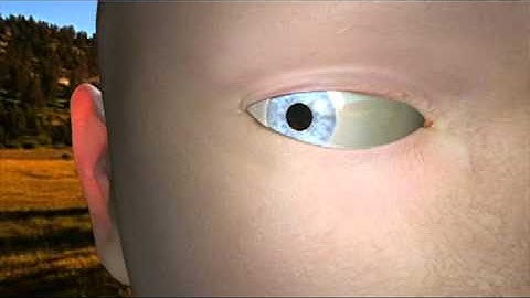 Eye Caustics SSS SDKs BumpMap GooeyBit