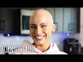 I Watched Myself Go Bald Three Times | BORN DIFFERENT
