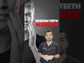 Wisdom Teeth Warning | Remove Them Before It’s Too Late