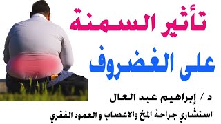 تاثير زيادة الوزن السمنه علي الغضروف مع الدكتور ابراهيم عبد العال استشارى جراحة العمود الفقرى