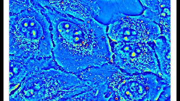 High res imaging of U2-OS cell culture using SLIM