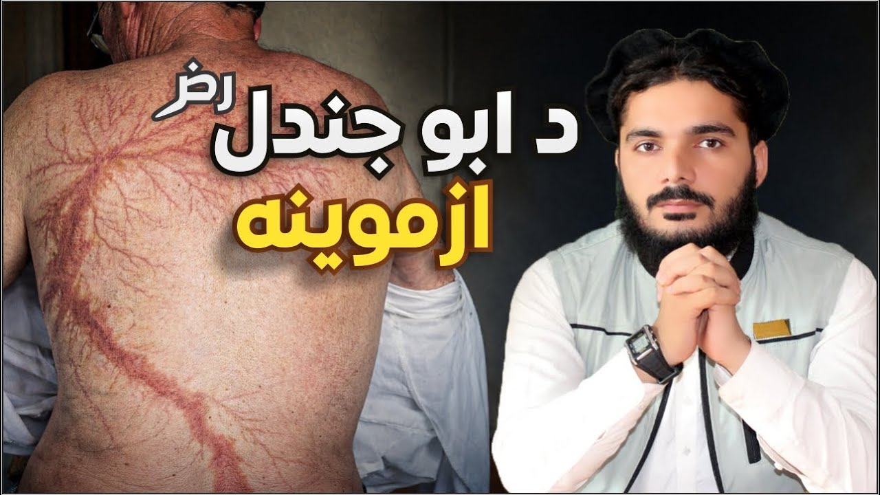 رسول الله ﷺ ولې ابو جندلؓ بېرته وسپاره؟ | د حدیبیې د صلحې ترخه شېبه | سلیمان نبي زاده | د تاریخ عبرت