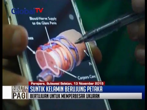 Puluhan Pria Mengalami Infeksi Setelah Suntikkan Campuran Cairan Ke Penisnya - BIP 16/11