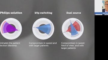 Webinar IQon Elite Spectral CT