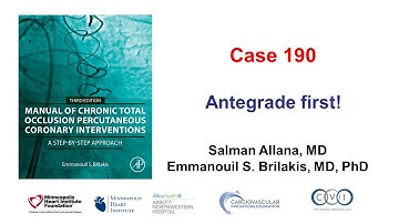 Case 190: Manual of CTO PCI - Antegrade first