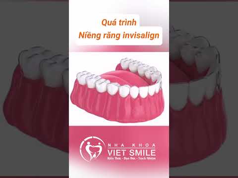Quá trình niềng