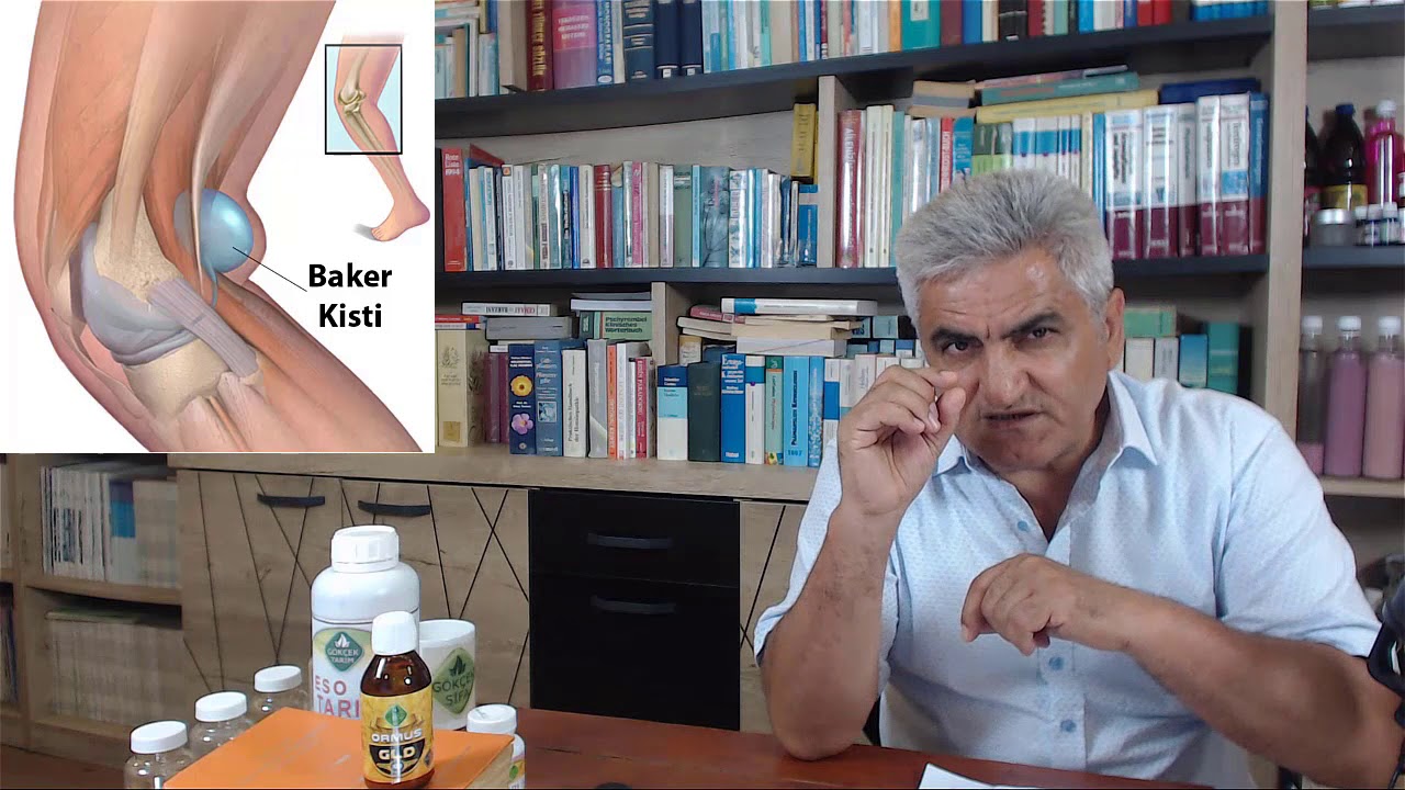 baker kisti nedir baker kistine ne iyi gelir baker kisti nasil gecer youtube