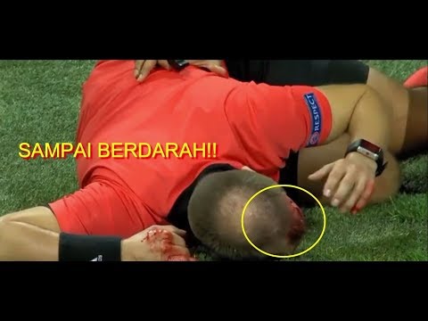 Video: Selepas Serangan Di Jalan, Pemain Bola Itu Terselamat, Tetapi Kehilangan Separuh Kepalanya - Pandangan Alternatif