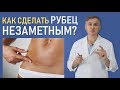 ШРАМ после операции: ❗️❗️КАК СДЕЛАТЬ НЕЗАМЕТНЫМ?