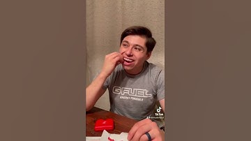 Byte Teeth Aligners Week 6 Update