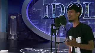 viral !!! valdy nyonk sakit gigi megie z | Indonesia idol