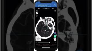 In App 3D DICOM Image Viewing screenshot 1