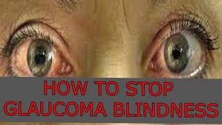 How to stop glaucoma silent eye blinding disease.