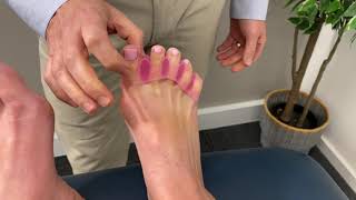 How to solve bunions in 3 steps