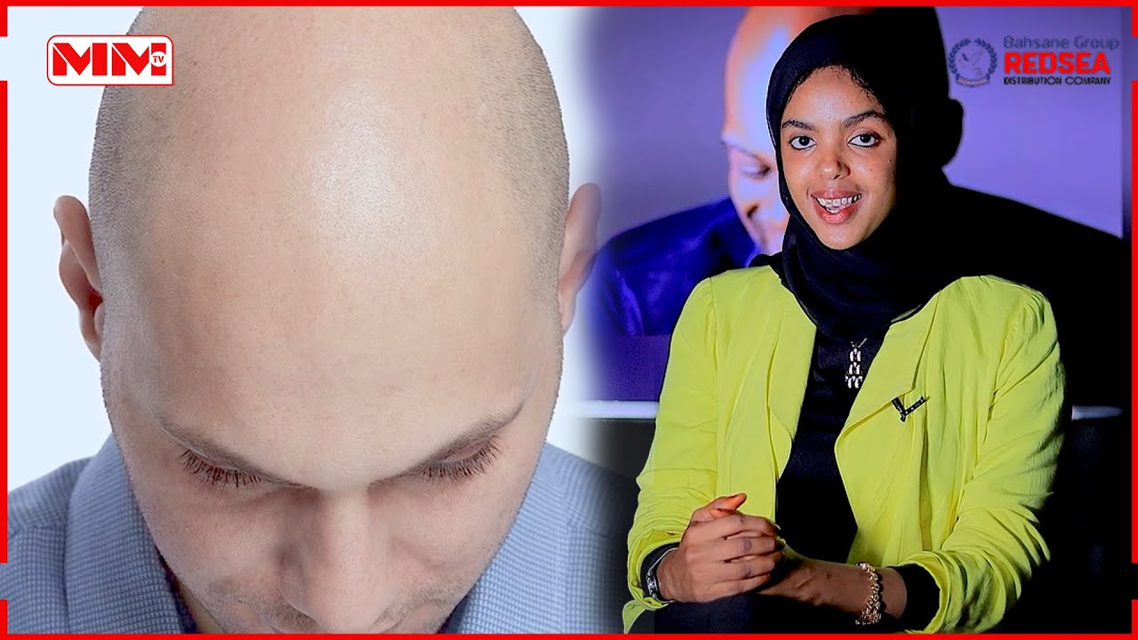 Ma ogtahay in Madaxa bidaarta lihi ka nasiib badan yahay madaxa timaha ...