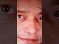Vijay Kadam Actor Cancer Struggle #cancer Dr Patil Dr Phatak Girish Sushil