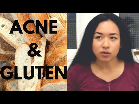 ACNE AND GLUTEN (COULD THIS BE THE CAUSE OF YOUR ACNE?)