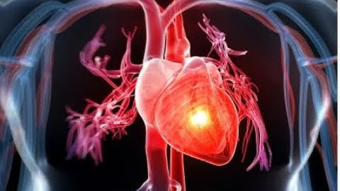 Cập nhật chẩn đoán và điều trị suy tim cấp trên người cao tuổi