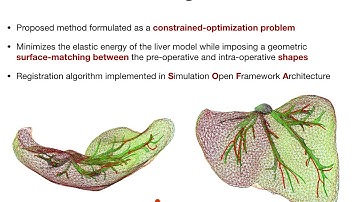 Fast Elastic Registration of Soft Tissues under Large Deformations