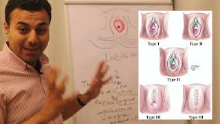 2- Anatomy of external genitalia - Gyn