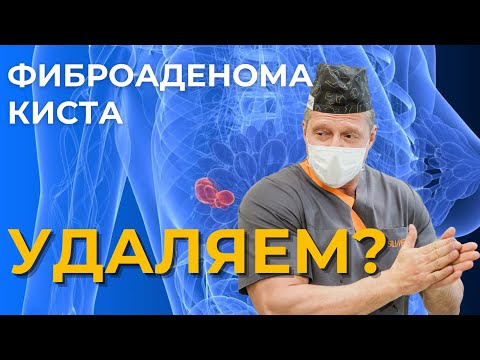 Фиброаденома и киста молочной железы  | Опасно ли и как лечиться?