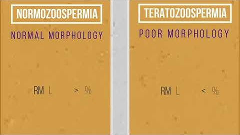 Semen analysis Samples- OLIGOZOOSPERMIA, ASTHENOZOOSPERMIA , TERATOZOOSPERMIA| SPERM COUNT