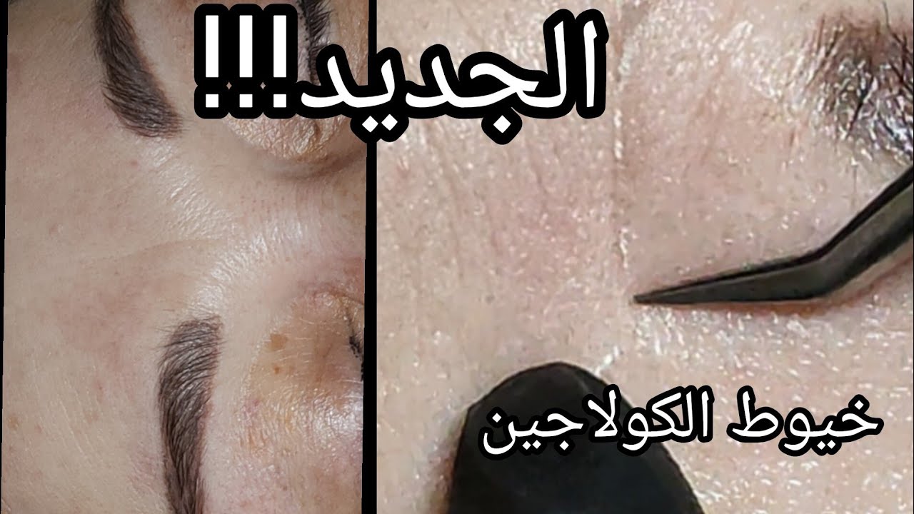 الجديد!!! خيوط الكولاجين🤩😍💯