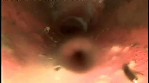 Sewer Scope for 365 Logan Ave, Loveland, CO 80537