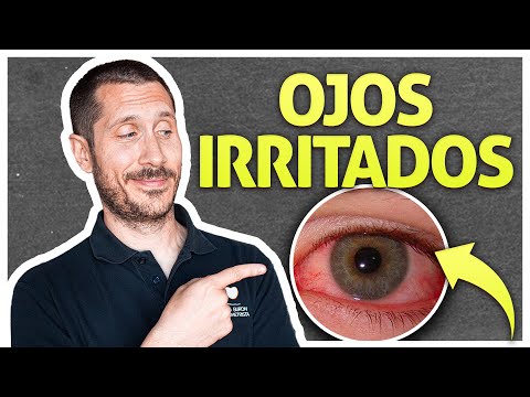 Vídeo: Ojos Hinchados Por El Llanto: 13 Remedios Para Los Ojos Hinchados, Rojos O Secos