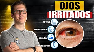 8 NATURAL REMEDIES FOR IRRITATED EYES