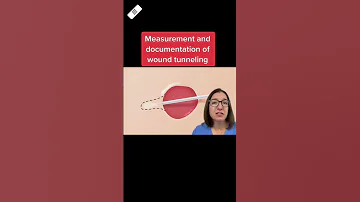 Wound Tunneling Wound Care SHORT LevelUpRN 