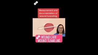 Wound tunneling: Wound Care SHORT | @LevelUpRN screenshot 5