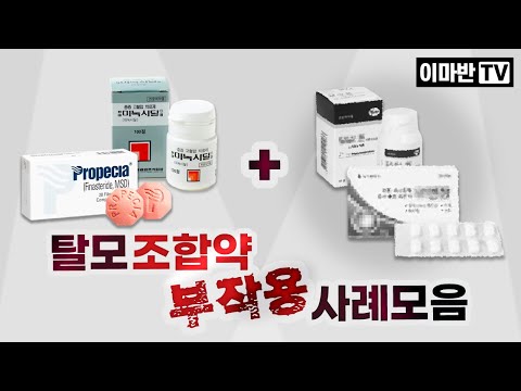 효과와 부작용, 갑론을박이 끊이지 않는 탈모 조합약 복용 사례모음 | 다모증,여유증,신장기능이상 등등