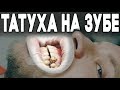 Необычная татуировка на зубе. Впервые в России. Сколько стоит