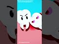 Wisdom Teeth Extraction#wisdomteethremoval #wisdomteethextraction #wisdomteethextractions🦷