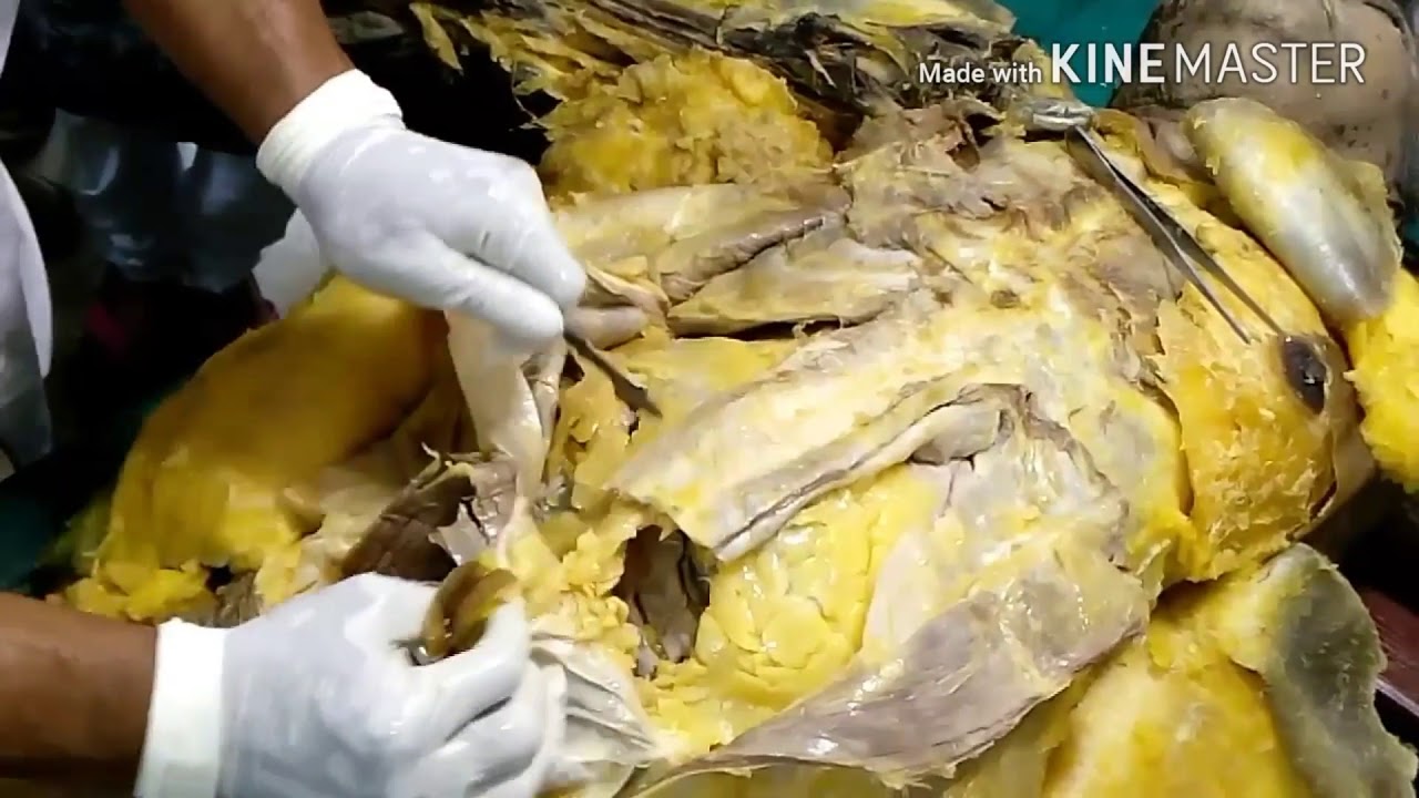 Dissection of abdomen camera iphone 8 plus apk