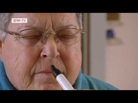 Parkinsons Disease the art of early diagnosis | To...