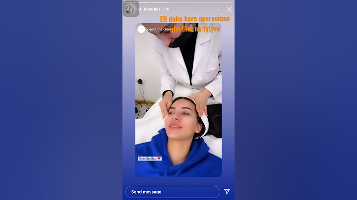 Efi duke bere operacione plastike  ne fytyre ( 100% e vertet )