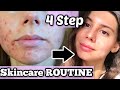 MY EFFECTIVE EASY 4 STEP SKINCARE FOR HEALING ACNE SCARS || Hyperpigmentation, spots, blemishes