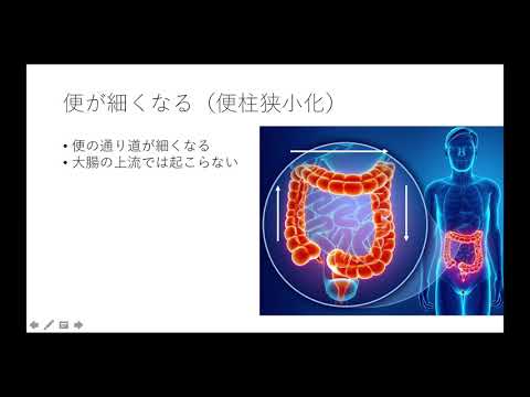 【医師が解説】大腸がんの5つの症状を分かりやすく解説！