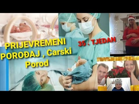 Video: Trudnost U 35. Sedmici: Priprema Za Porod