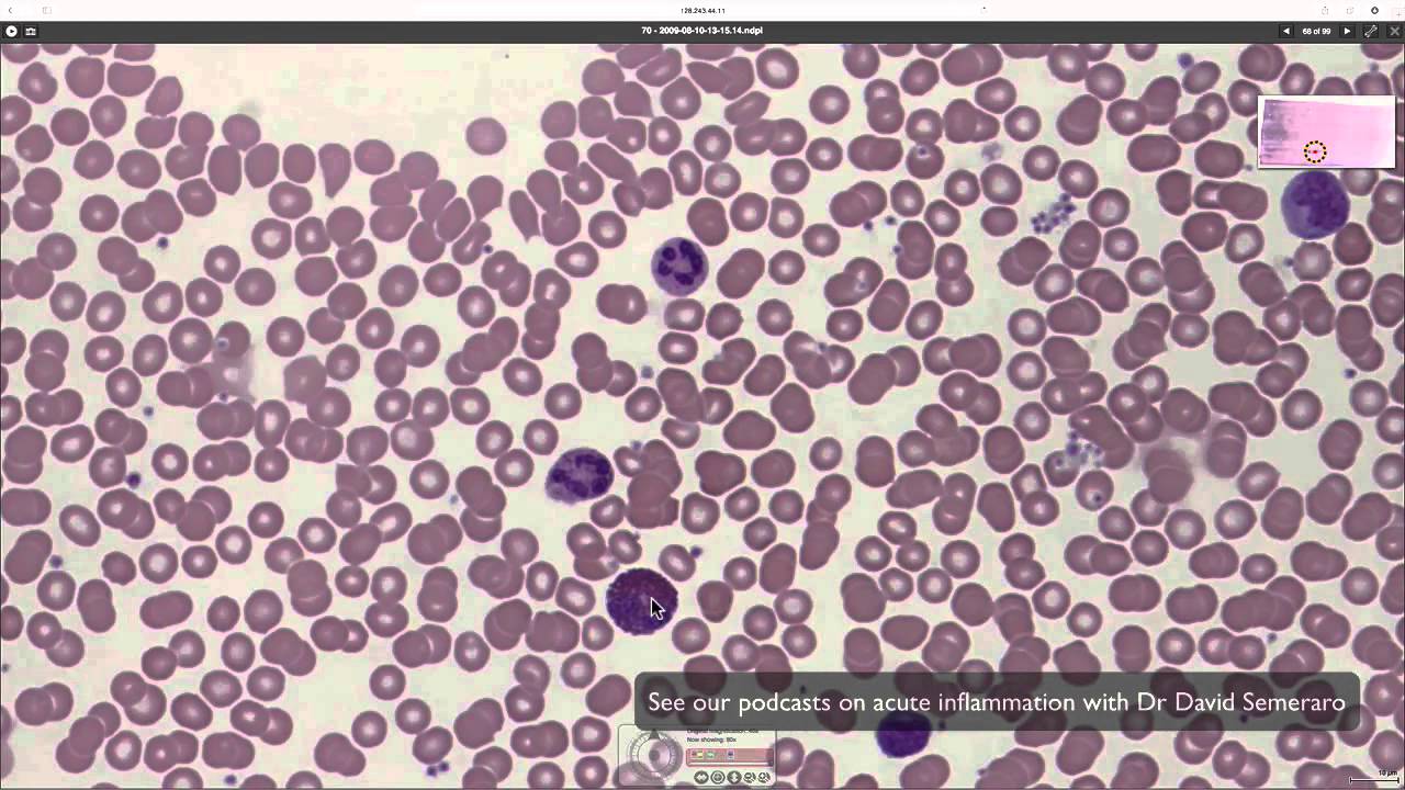 What blood looks like down the microscope - YouTube