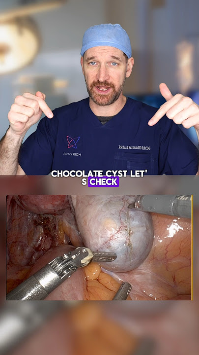 Kista Cokelat - bagaimana prosedurnya? #kesehatanwanita #kistacokelat #ovarium #pemecahankista