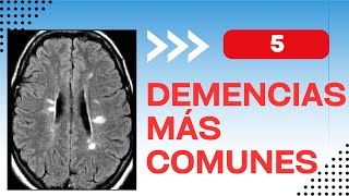 The 5 Most Common Types of Dementia in the World