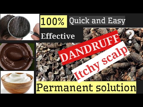 how-to-get-rid-of-dandruff-&-itchy-scalp-permanently-and-naturally-at-home.